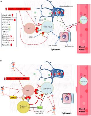 Potential Role of Chronic Physical Exercise as a Treatment in the Development of Vitiligo